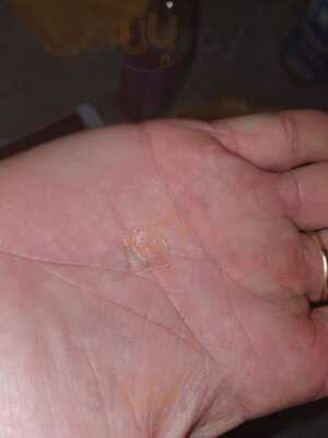 Hotrocks Flame Grill